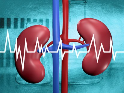 Cancer de rinichi / renal / Carcinom celular renal